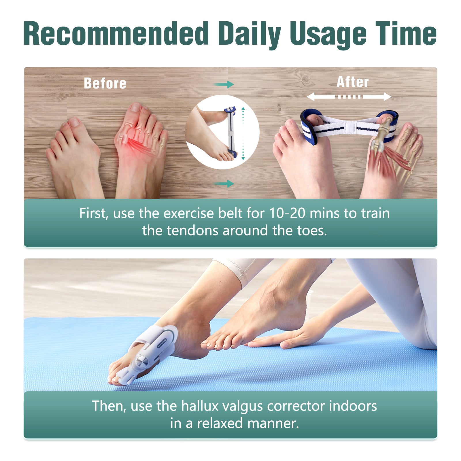 Bunion Corrector - Presale (Expect to Ship by 20th May)